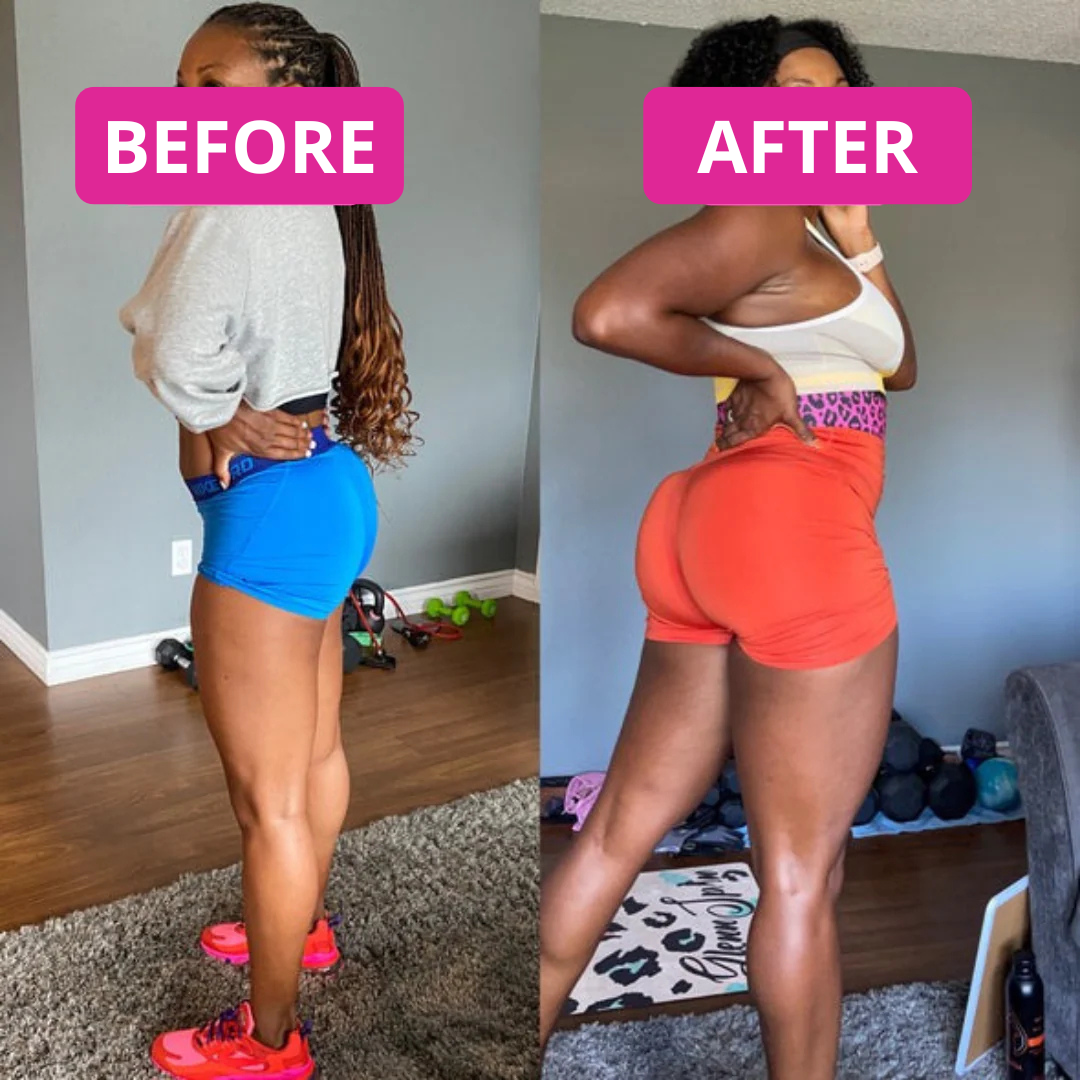 Shape & Curve Support Gummies